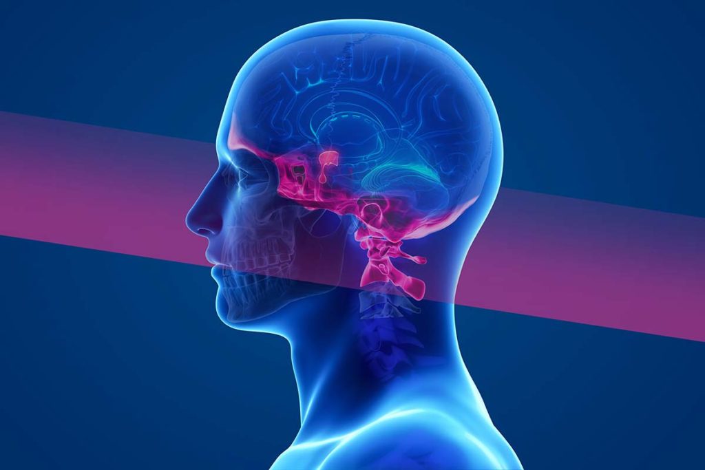The image shows a side profile of the head and neck. The region of the skull base is highlighted. The skull base, or bottom of the skull, is a complex anatomic region where multiple critical neurovascular structures pass by or through. Above the skull base sits the pituitary gland, also highlighted. The pituitary gland is the master regulator of the body’s production of several hormones critical for normal function.