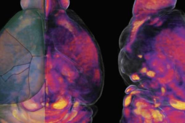 A scan shows a view of a mouse brain from two different vantage points.